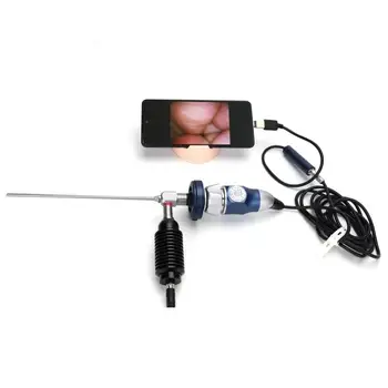 1080P Medicīnisko Endoskopu Kameru VALDĪBA Ķirurģija un Pārbaudes - HDMI & USB Video Izeja Klīnika & Izmantošanai Slimnīcā