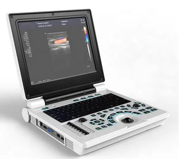 Medicīnas Kardioloģijas portatīvo 12 collu ultraskaņas mašīna ciparu ultraskaņas skeneris grāmatiņa USG krāsu doplera ultraskaņas sistēmu